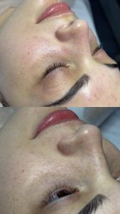 مشاهده خدمات تخصصی فیشال پوست بیگی در عفیف آباد شیراز در سامانه بهبود مشاغل
