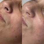 خدمات تخصصی  فیشال پوست بیگی در عفیف آباد شیراز