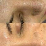 خدمات تخصصی  فیشال پوست بیگی در عفیف آباد شیراز