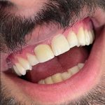 کلینیک دندانپزشکی کاسپید در سعدی زنجان