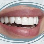 کلینیک دندانپزشکی کاسپید در سعدی زنجان