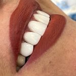 کلینیک دندانپزشکی کاسپید در سعدی زنجان