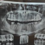 کلینیک دندانپزشکی کاسپید در سعدی زنجان