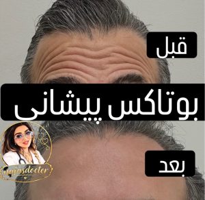 مشاهده خدمات تخصصی فیلر و بوتاکس فاطمه زینی در ارتش تبریز در سامانه بهبود مشاغل
