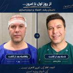 کلینیک تخصصی کاشت مو جوانه در ولیعصر تبریز
