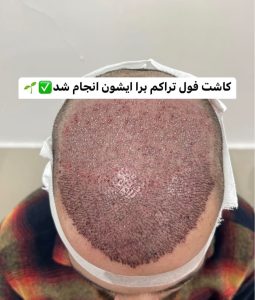 مشاهده کلینیک تخصصی کاشت مو جوانه در ولیعصر تبریز در سامانه بهبود مشاغل