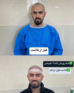 مشاهده کلینیک تخصصی کاشت مو جوانه در ولیعصر تبریز در سامانه بهبود مشاغل