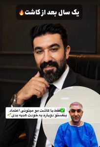مشاهده کلینیک تخصصی کاشت مو جوانه در ولیعصر تبریز در سامانه بهبود مشاغل