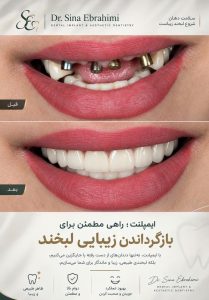 مشاهده کلینیک تخصصی دندانپزشکی دکتر شجاع در 17 شهریور تبریز در سامانه بهبود مشاغل