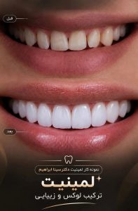 مشاهده کلینیک تخصصی دندانپزشکی دکتر شجاع در 17 شهریور تبریز در سامانه بهبود مشاغل
