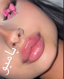 مشاهده خدمات تخصصی ژل و بوتاکس نرگس سیاحت در زنبیل آباد قم در سامانه بهبود مشاغل