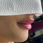 خدمات تخصصی ژل و بوتاکس نرگس سیاحت در زنبیل آباد قم
