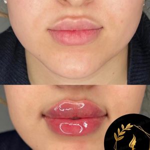 مشاهده خدمات تخصصی ژل و بوتاکس نرگس سیاحت در زنبیل آباد قم در سامانه بهبود مشاغل