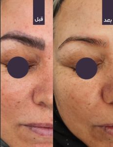 مشاهده کلینیک زیبایی ریما در لارستان در سامانه بهبود مشاغل