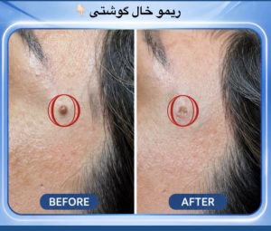 مشاهده کلینیک زیبایی ریما در لارستان در سامانه بهبود مشاغل