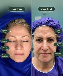 مشاهده مطب تخصصی گوش و حلق و بینی دکتر حسین اشراقی در تهرانسر تهران در سامانه بهبود مشاغل