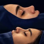 مطب تخصصی گوش و حلق و بینی دکتر حسین اشراقی در تهرانسر تهران