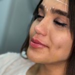 مرکز تزریق فیلر بادی برنا در اصفهان