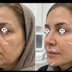 خدمات پلاسما جوانسازی و لکه صدف نظری در گلدشت کرمان