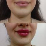 کلینیک زیبایی اف بیوتی در نازی آباد تهران