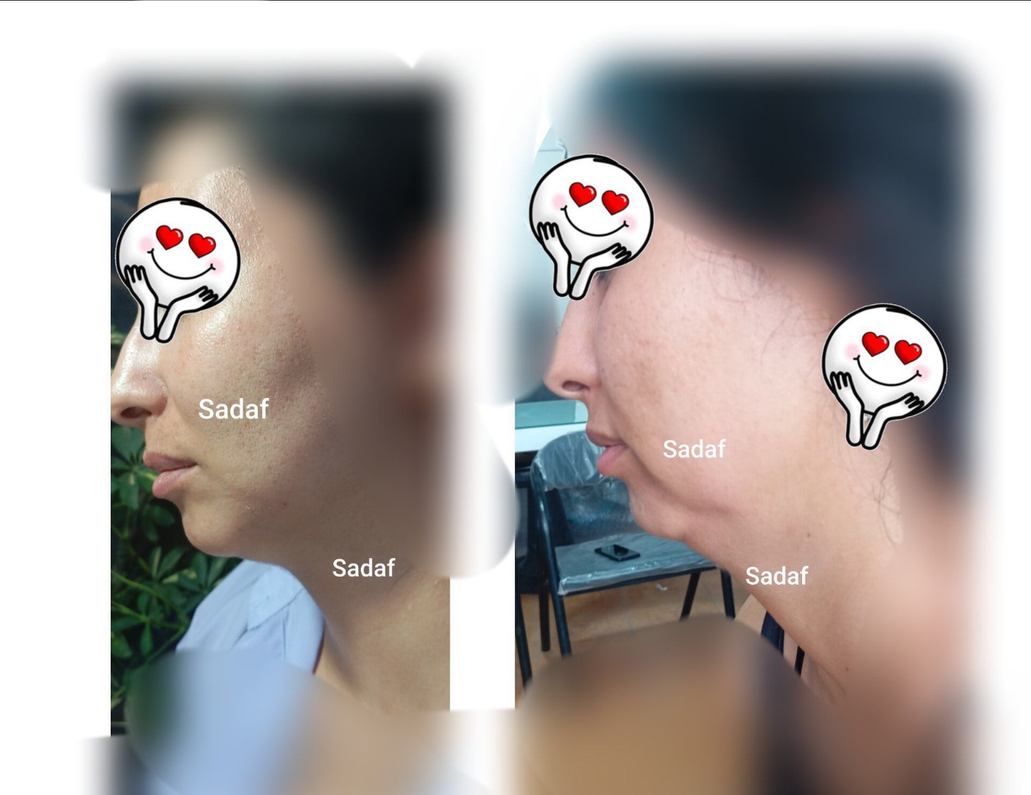 مشاهده خدمات پلاسما جوانسازی و لکه صدف نظری در گلدشت کرمان در سامانه بهبود مشاغل